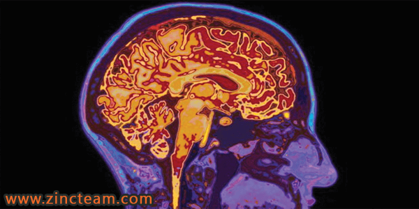 دستکاری مغز موقع جراحی برای خنداندن بیمار|گروه بازرگانی زینک تیم