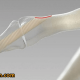 یک روش نوین برای ترمیم شکستگی استخوان